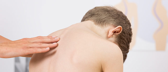 Chiropractic Chanhassen MN Chiropractic Care For Scoliosis Chiropractic Chanhassen MN Chiropractic Care For Scoliosis